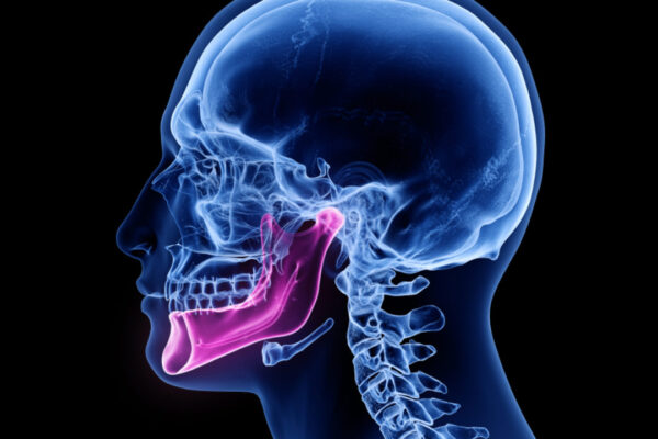 TMJ Disorders